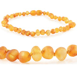 Amber Necklaces by R.B. Amber Jewelry (Small - 10-11") - Raw Honey