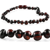 Amber Necklaces by R.B. Amber Jewelry (Small - 10-11") - Polished Cherry