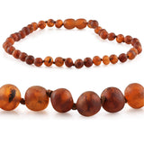 Amber Necklaces by R.B. Amber Jewelry (Small - 10-11") - Raw Cognac